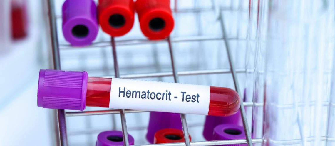 Qu'est-ce que l'hématocrite ?